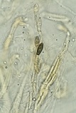 Lasiosphaeria lanuginosa image