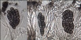 Diplotomma hedinii image
