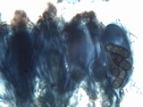Diplotomma hedinii image