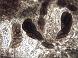 Buellia erubescens image