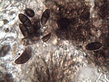 Buellia erubescens image