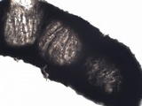 Pertusaria heterochroa image