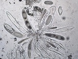Pertusaria heterochroa image