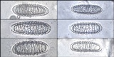 Pertusaria heterochroa image