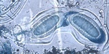 Pertusaria heterochroa image