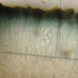 Lecidea laboriosa image
