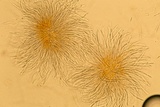 Hypomyces armeniacus image
