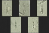 Hypomyces armeniacus image