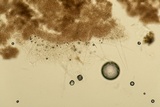 Myrothecium inundatum image