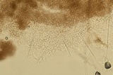 Myrothecium inundatum image
