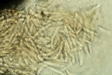 Bertia moriformis image