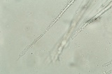 Myrothecium inundatum image