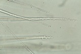 Myrothecium inundatum image