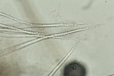Myrothecium inundatum image