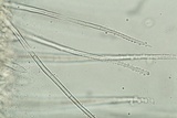 Myrothecium inundatum image