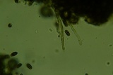 Camarosporidiella elongata image
