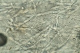 Hypomyces hyalinus image