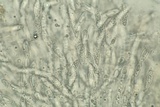 Hypomyces hyalinus image