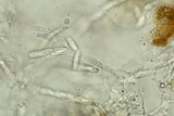 Hypomyces hyalinus image