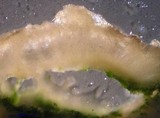 Ochrolechia parella image