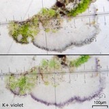 Micarea denigrata image
