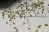 Muellerella erratica image