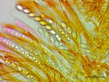 Neottiella vivida image