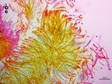 Neottiella vivida image