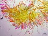 Neottiella vivida image