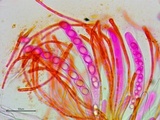 Neottiella vivida image