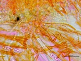 Neottiella vivida image