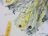 Neottiella vivida image