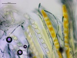Neottiella vivida image