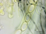Neottiella vivida image