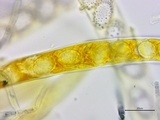 Neottiella vivida image