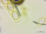 Neottiella vivida image