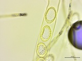 Neottiella vivida image