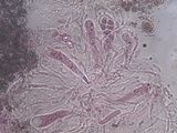 Aspicilia radiosa image