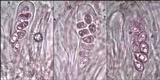 Aspicilia radiosa image