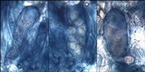 Aspicilia radiosa image