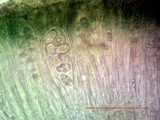 Aspicilia aquatica image
