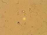 Clavariadelphus occidentalis image