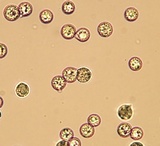 Amanita rhacopus image