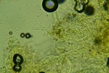 Odonticium laxum image