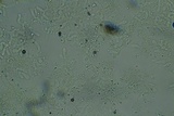 Odonticium laxum image