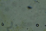 Odonticium laxum image