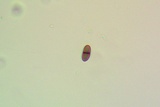 Buellia sequax image