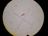 Tylopilus porphyrosporus image