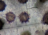 Scleroderma verrucosum image