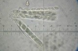 Lachnellula arida image